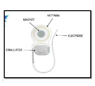 member img